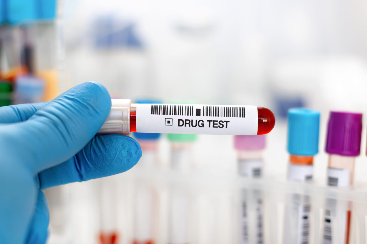 5-Panel Drug Test (Non-DOT) – Pure Testing